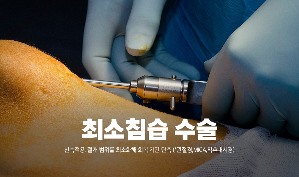 최소침습수술