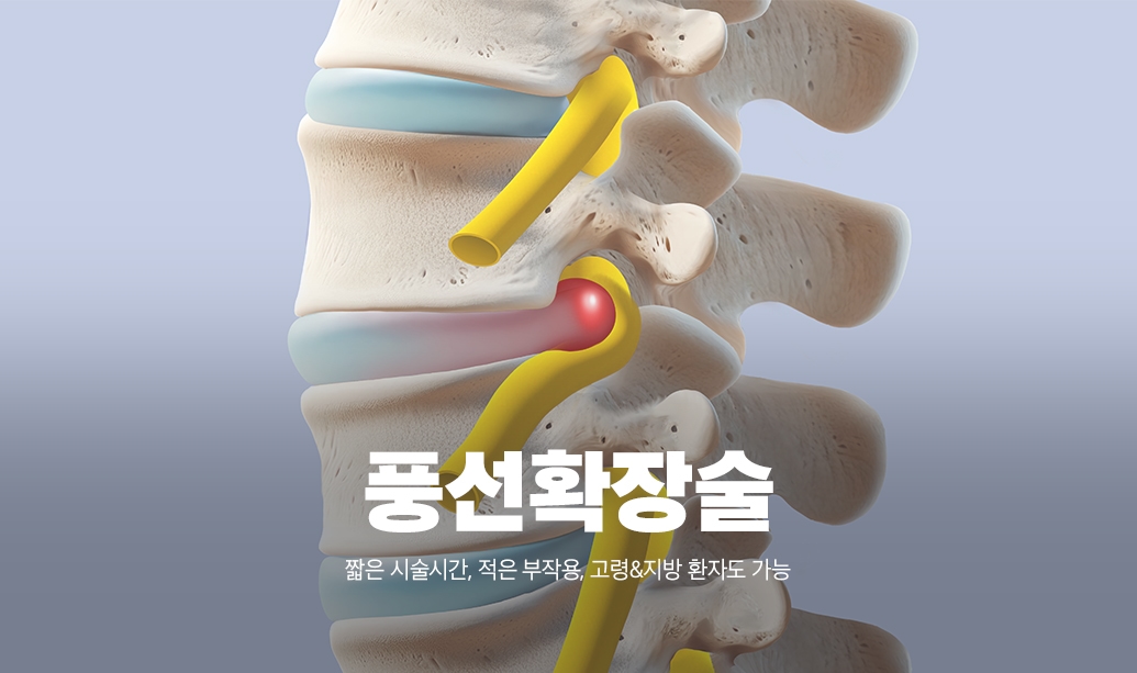 풍선확장술