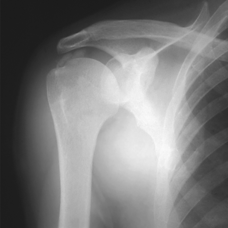 X-ray