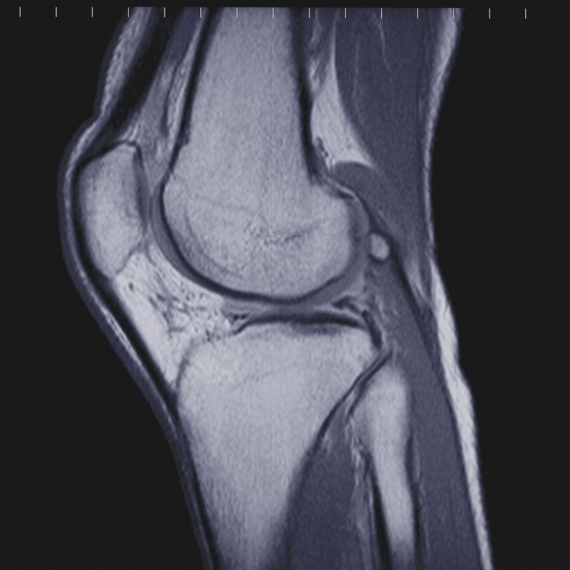 MRI