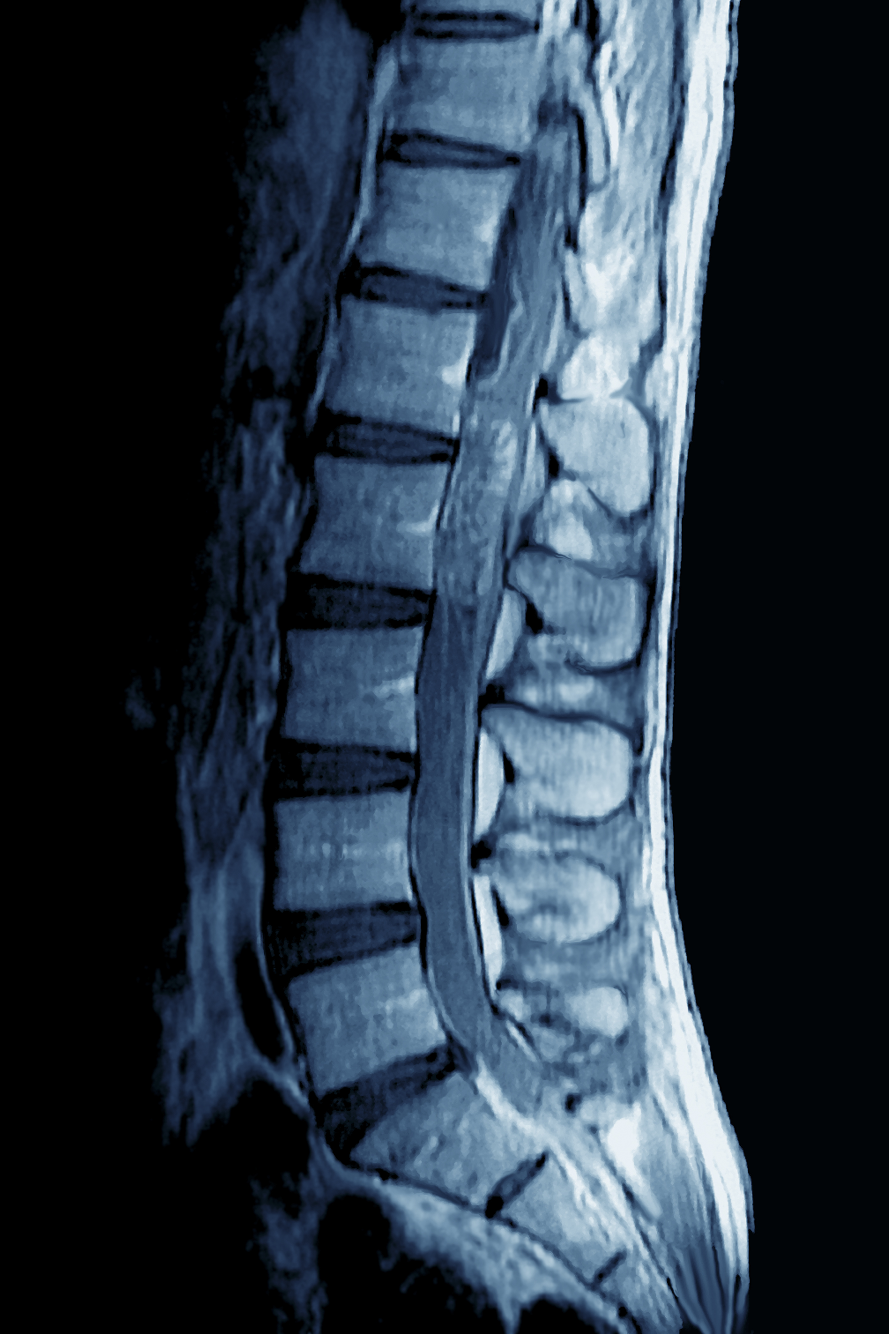 MRI (자기공명영상 검사)