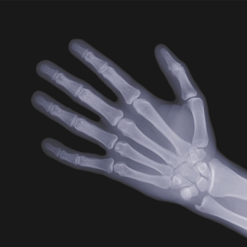 X-ray