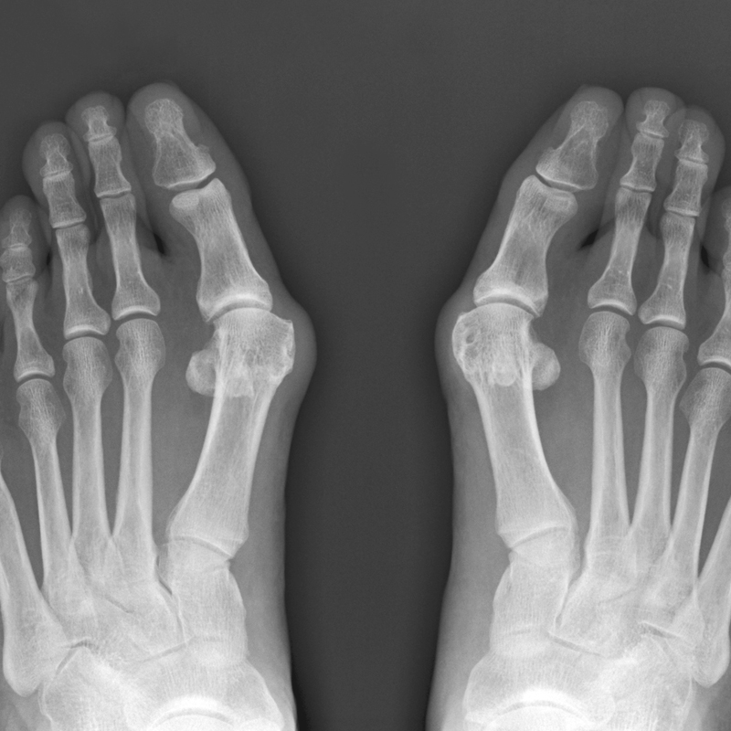 X-ray